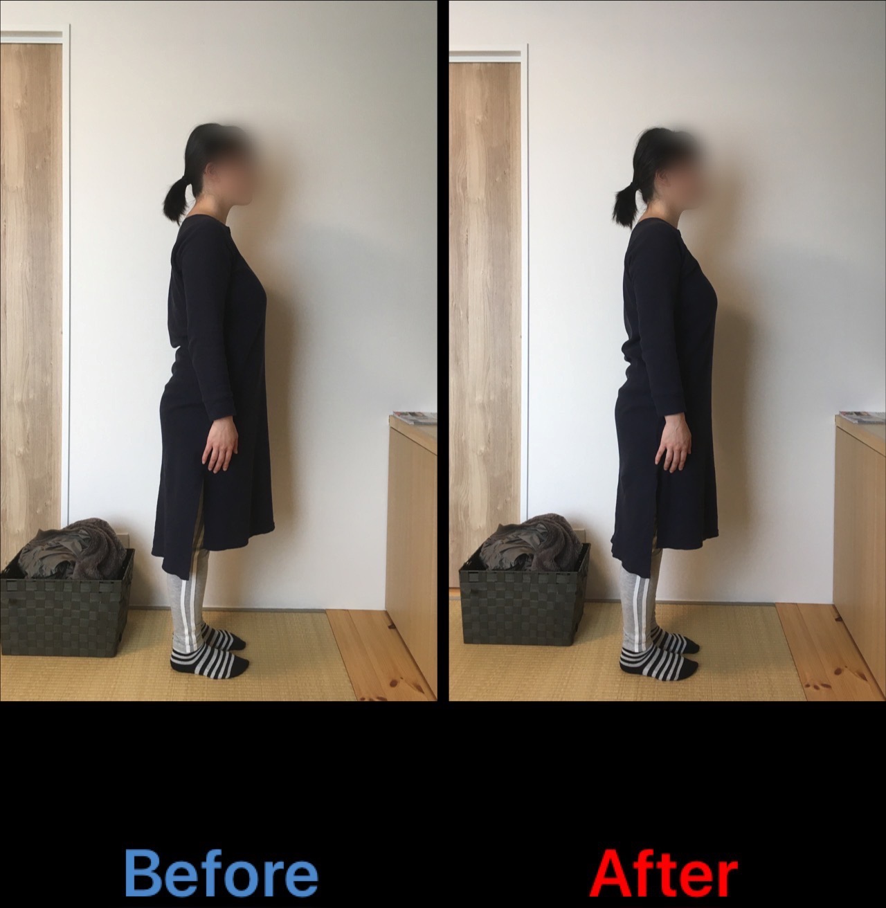 産後6ヵ月　反り腰