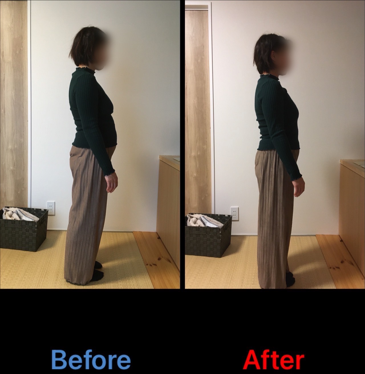 産後３ヵ月　反り腰